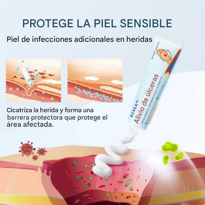 Crema para el tratamiento de la diabetes para el alivio de úlceras