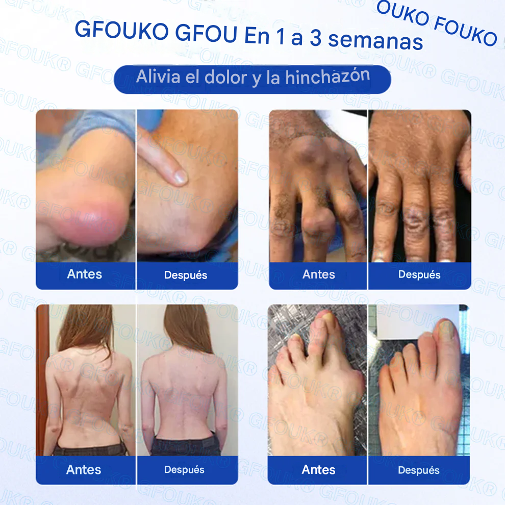 GFOUK® BPC-157 × AINE Gel penetrante no graso 10 en 1 para la artritis 🍀