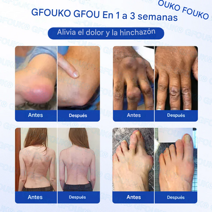 GFOUK® BPC-157 × AINE Gel penetrante no graso 10 en 1 para la artritis 🍀