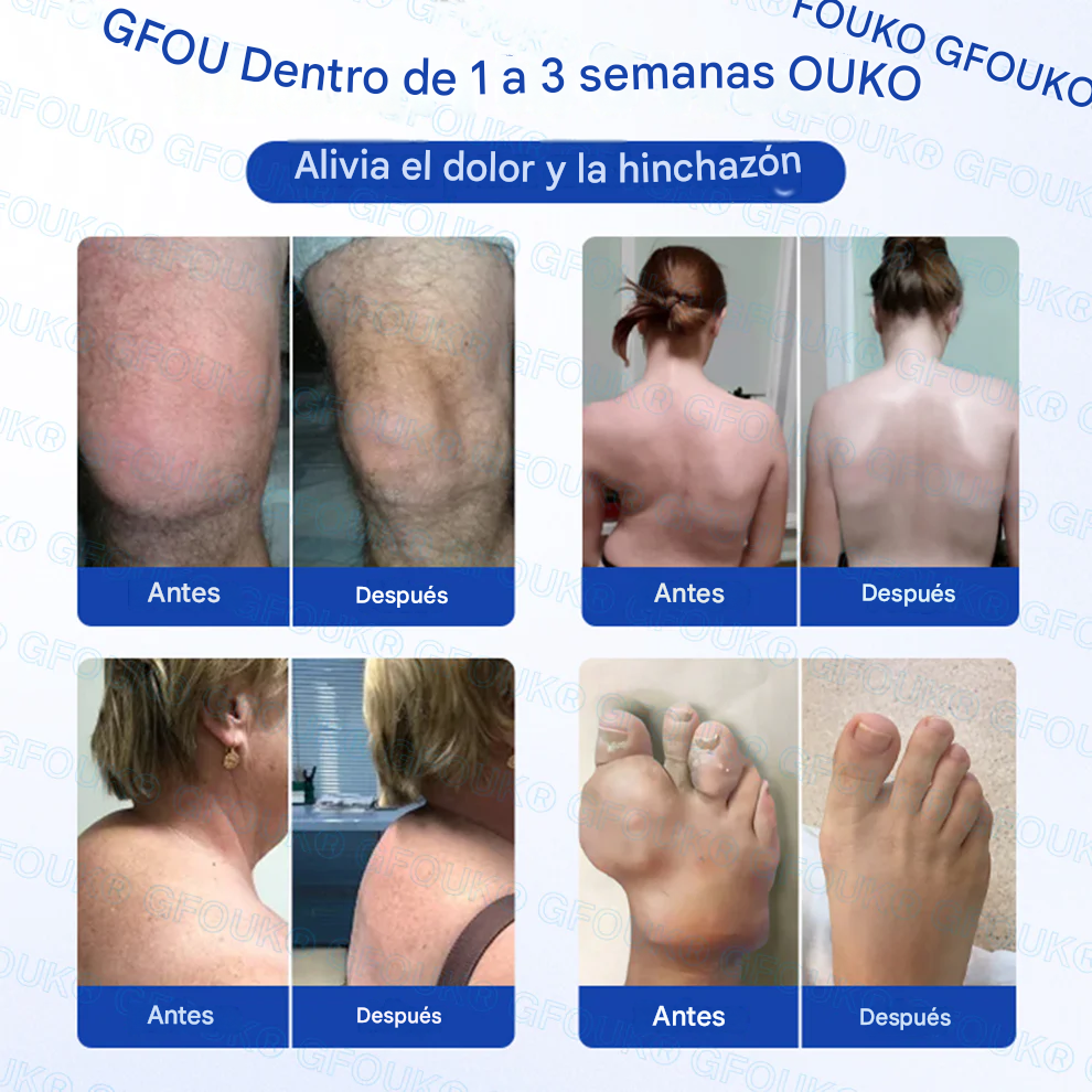 GFOUK® BPC-157 × AINE Gel penetrante no graso 10 en 1 para la artritis 🍀