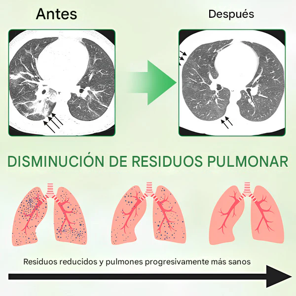 GFOUK®3X Spray concentrado de limpieza pulmonar con gordolobo