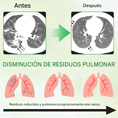 GFOUK®3X Spray concentrado de limpieza pulmonar con gordolobo