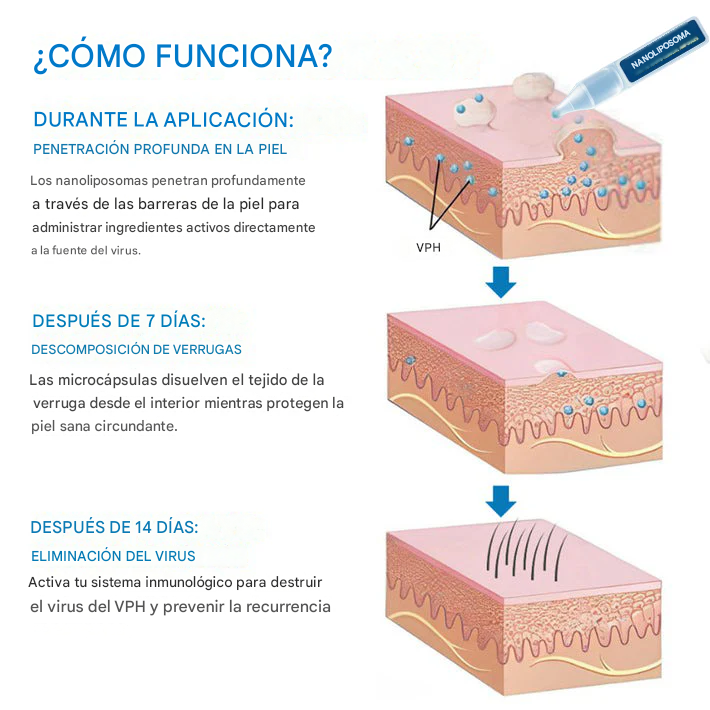 Ampollas clínicas NanoLipo para verrugas genitales