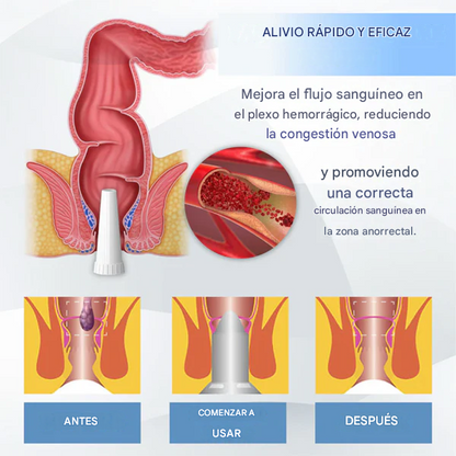 Gel para el tratamiento de las hemorroides