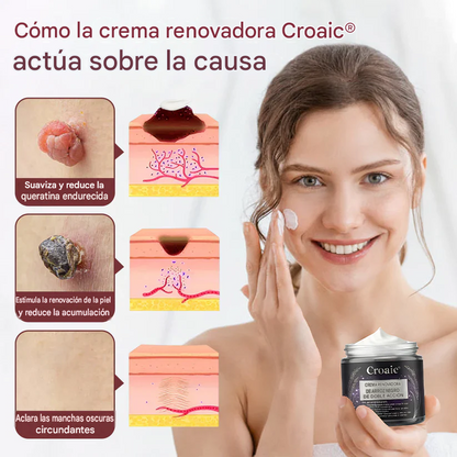 Crema regeneradora de doble acción Croaie KeraErase