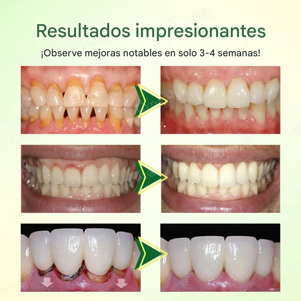 Spray bucal con propóleo
