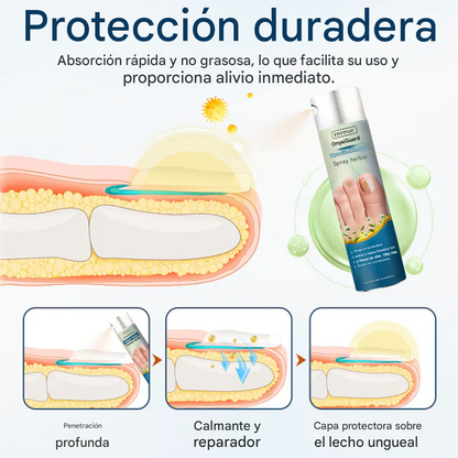 Spray herbal reparador de hongos Fivfivgo® OnyxiGuard