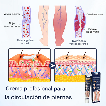 Crema para la circulación Timilk® SwellRelief