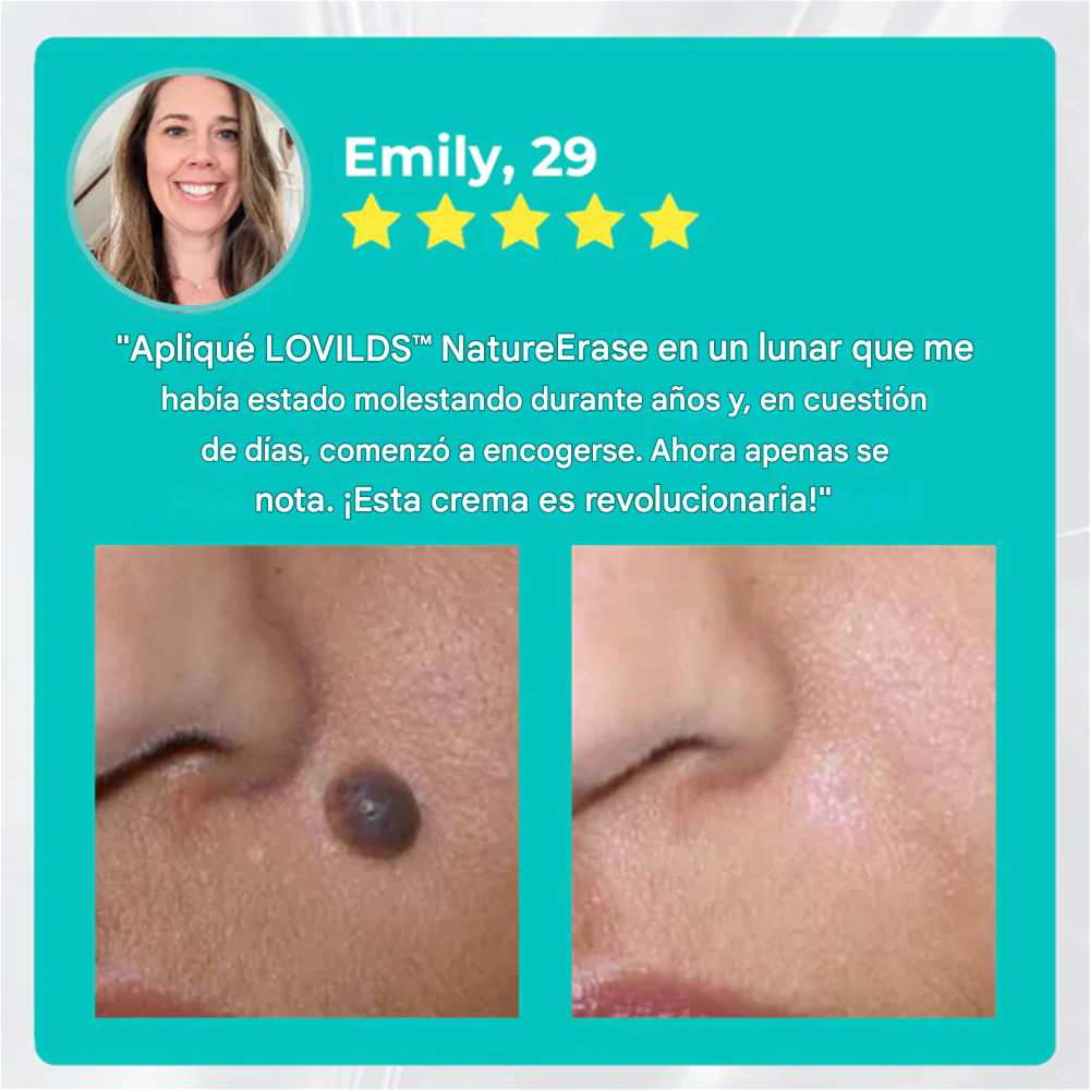 NatureErase Aceite de cocodrilo instantáneo Eliminador de lunares y manchas Plus Gel