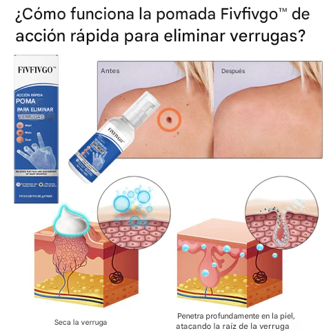 Ungüento Fivfivgo™ de acción rápida para la eliminación de verrugas