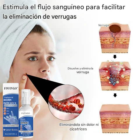 Ungüento Fivfivgo™ de acción rápida para la eliminación de verrugas
