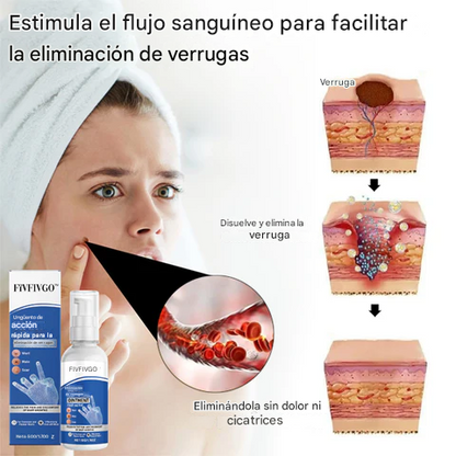 Ungüento Fivfivgo™ de acción rápida para la eliminación de verrugas