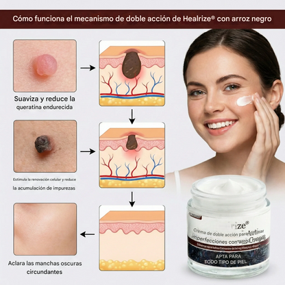 Healrize® Crema de Arroz Negro de Doble Acción para Eliminar Imperfecciones: elimina verrugas y suaviza la piel.