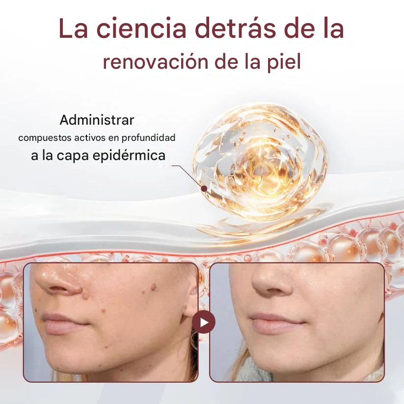 Healrize® Crema de Arroz Negro de Doble Acción para Eliminar Imperfecciones: elimina verrugas y suaviza la piel.