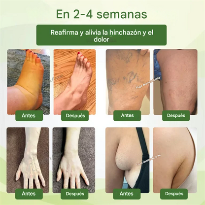 DetoxFlow™ SwellSo la superficie linfática