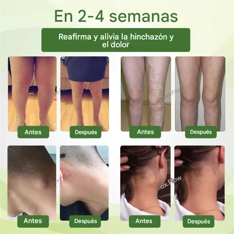 DetoxFlow™ SwellSo la superficie linfática