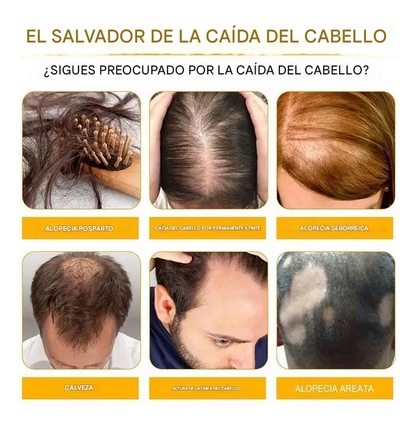 Spray de esencia para el crecimiento del cabello con biotina Fivfivgo™