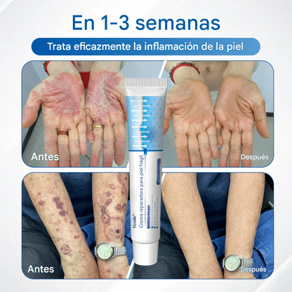 Crema reparadora para pieles frágiles Timilk® 🛡️🌿 Multireparación para hematomas, sequedad y manchas