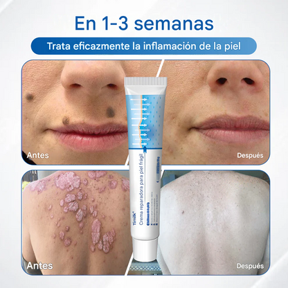 Crema reparadora para pieles frágiles Timilk® 🛡️🌿 Multireparación para hematomas, sequedad y manchas