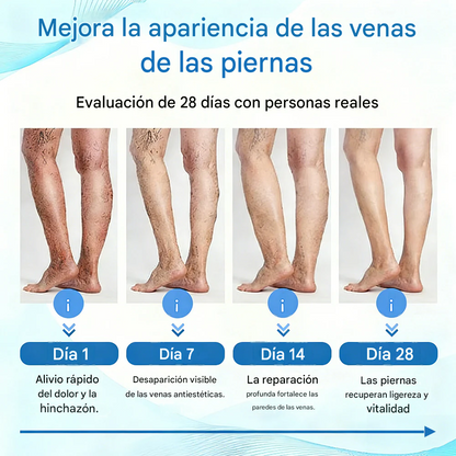 ® VEINRX Spray Curativo Diseñado para varices, arañas vasculares, trombosis venosa profunda