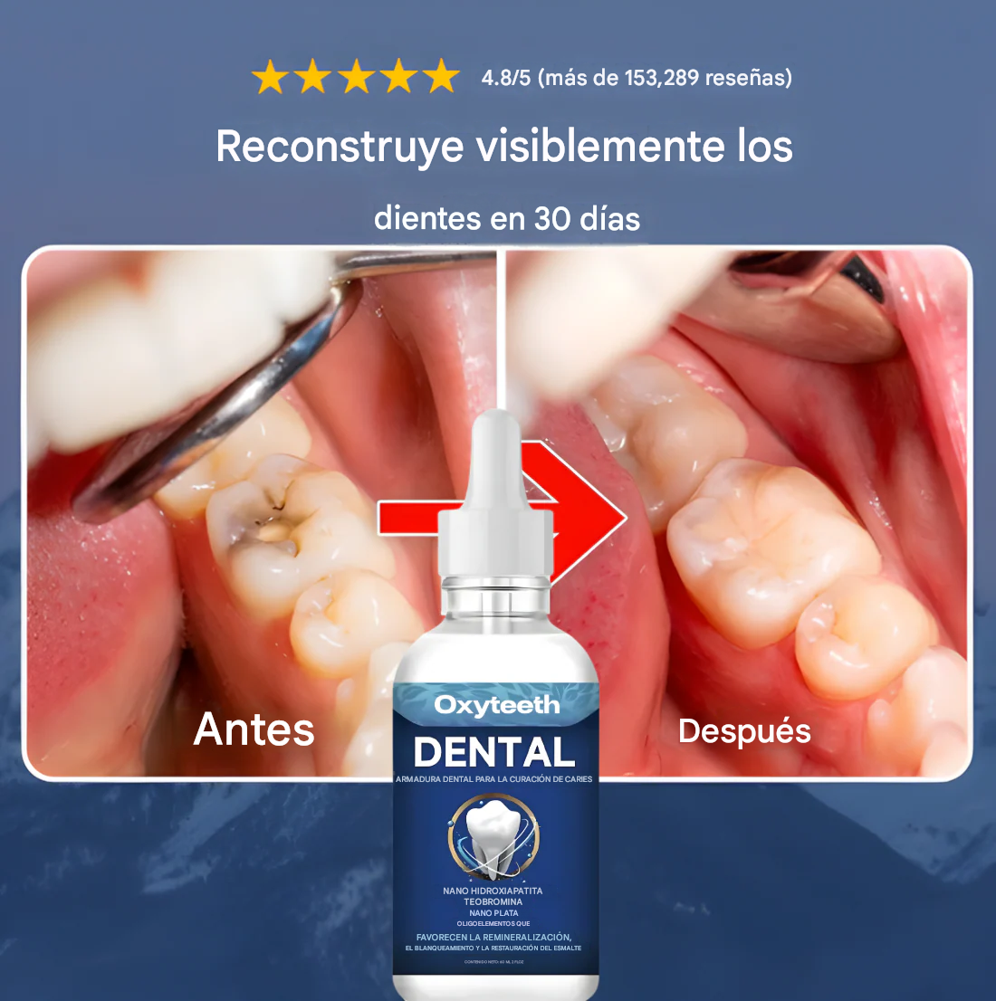 Armadura dental OxyTeeth 🫧🦷