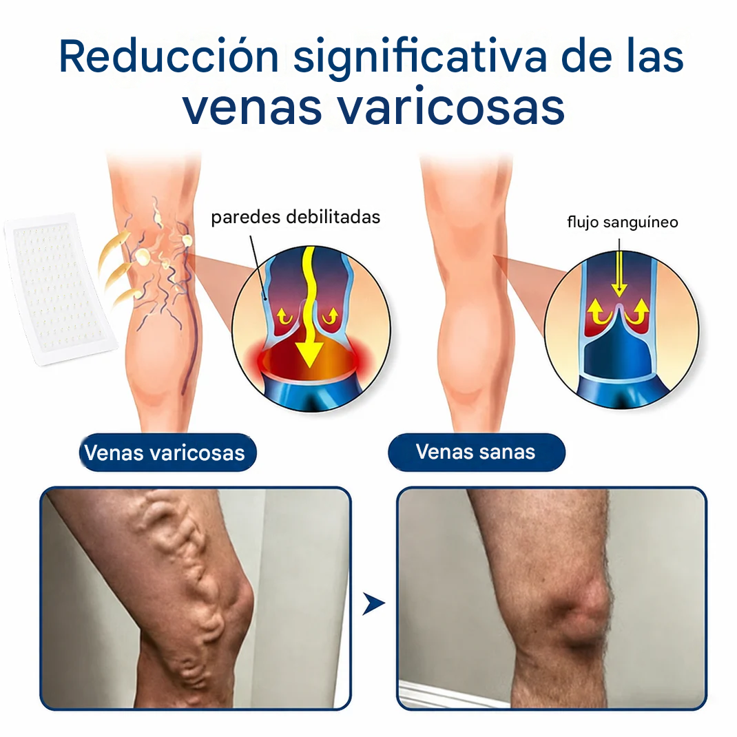 Parche de microagujas para el contorno de venas con liberación avanzada de diosmina y hesperidina