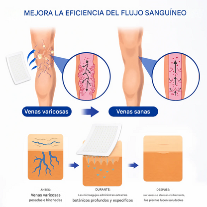 Parche de microagujas para el contorno de venas con liberación avanzada de diosmina y hesperidina