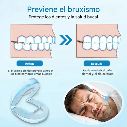 Protector dental DreamGuard contra los ronquidos y el bruxismo