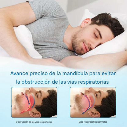 Protector dental DreamGuard contra los ronquidos y el bruxismo