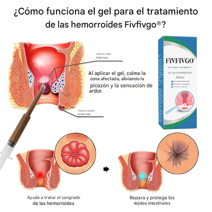 Gel para el tratamiento de las hemorroides