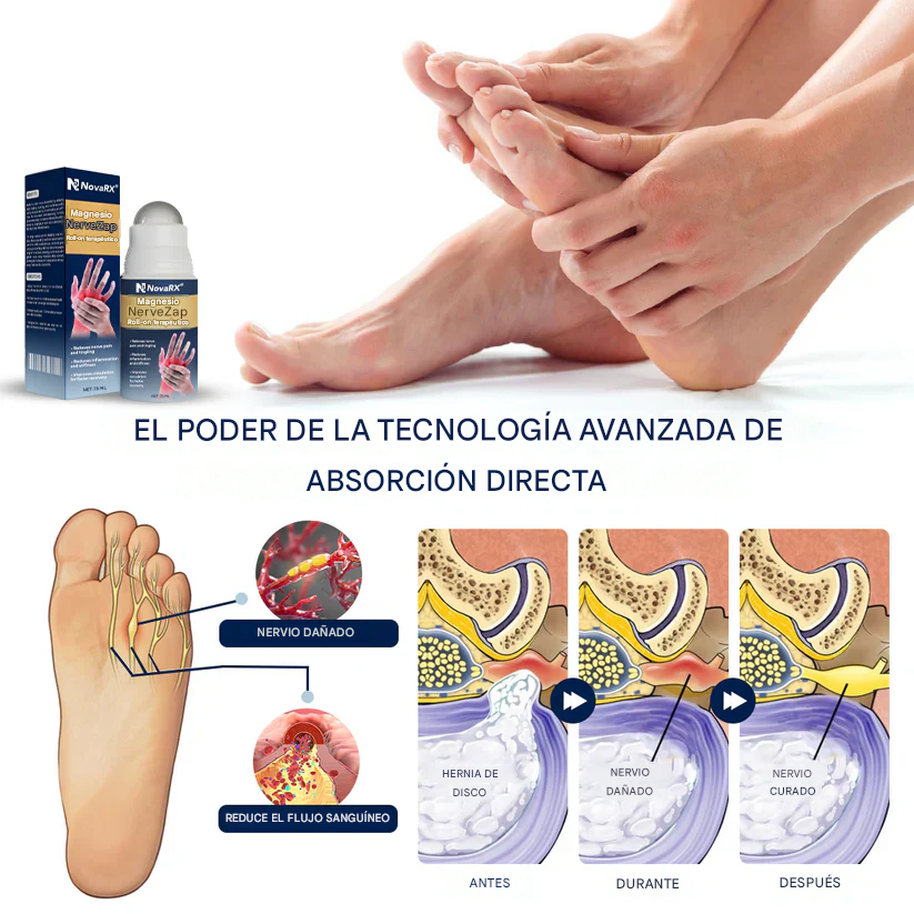 Roll-on de terapia con magnesio NerveZap