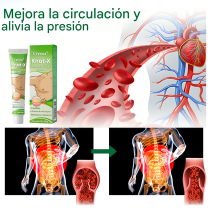 Crema disolvente de lipomas Knot-X