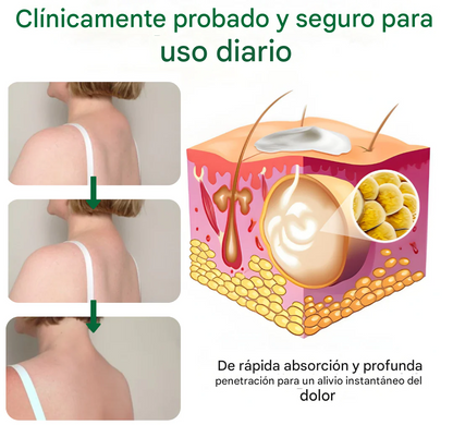 Crema disolvente de lipomas Knot-X