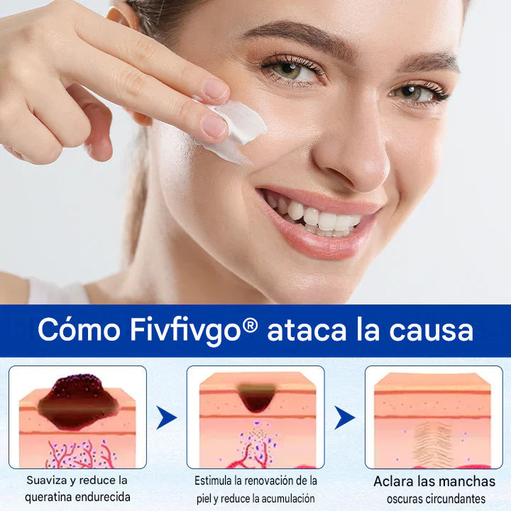 Ungüento herbal WartClear