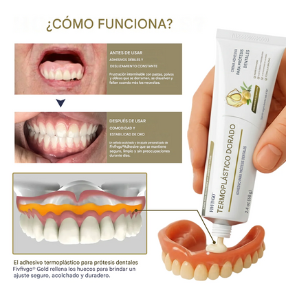 Adhesivo termoplástico para prótesis dentales Gold
