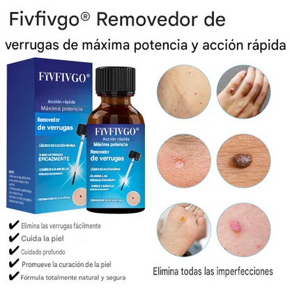 Removedor de verrugas de máxima potencia y acción rápida