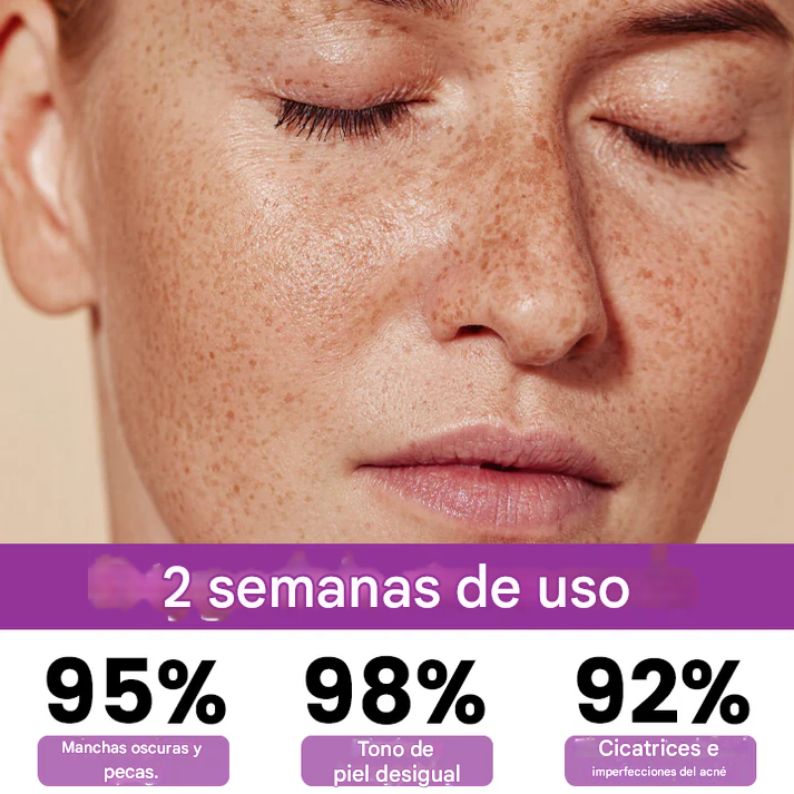 ✨Ceoerty® MelantraX Esencia Anti-decoloración Avanzada