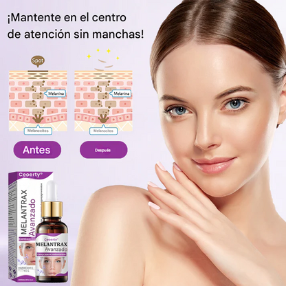 ✨Ceoerty® MelantraX Esencia Anti-decoloración Avanzada