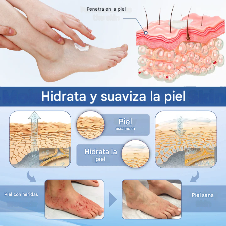 Timilk® AngioVita Spray para el cuidado de la diabetes