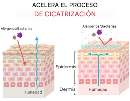 Crema antibacteriana privada