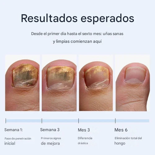 Lápiz antimicótico QIAWI