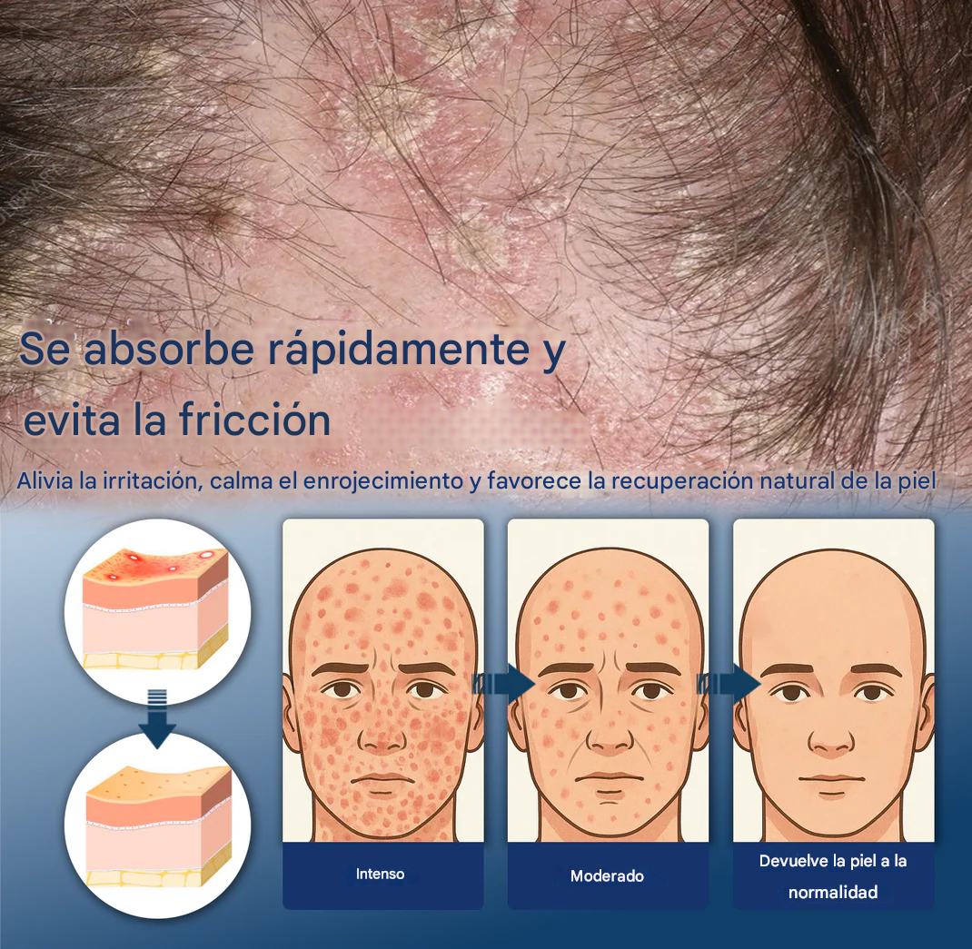 ATTDX® PsoriEase Espuma curativa de magnesio