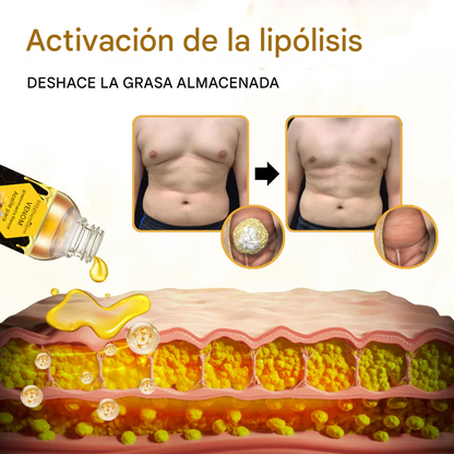 Aceite de veneno de abeja Biancat™ ThermoFirm para la ginecomastia