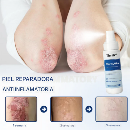 Timilk® PsoriCure Spray herbal de magnesio