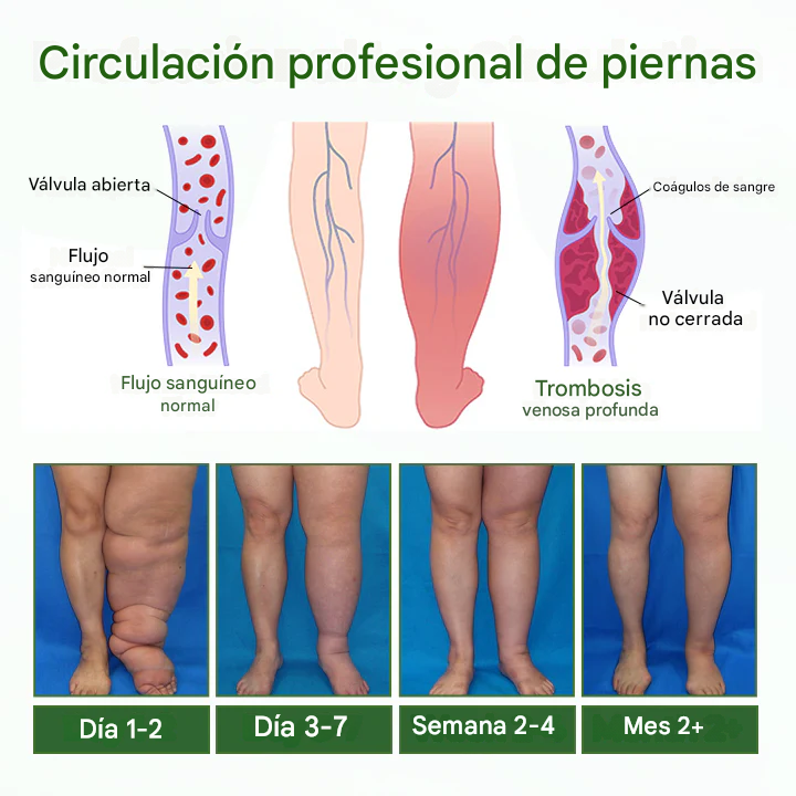 Drenaje Linfático Timilk®: Llévala por $79.900 o Ahorra con 2 Cremas por $99.900