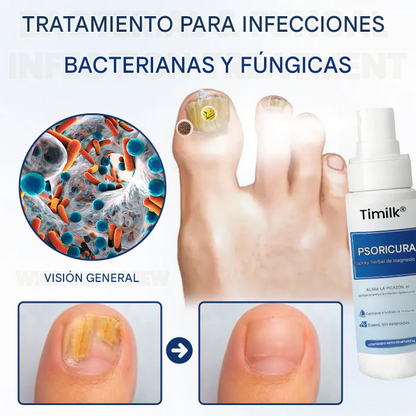 Timilk® PsoriCure Spray herbal de magnesio