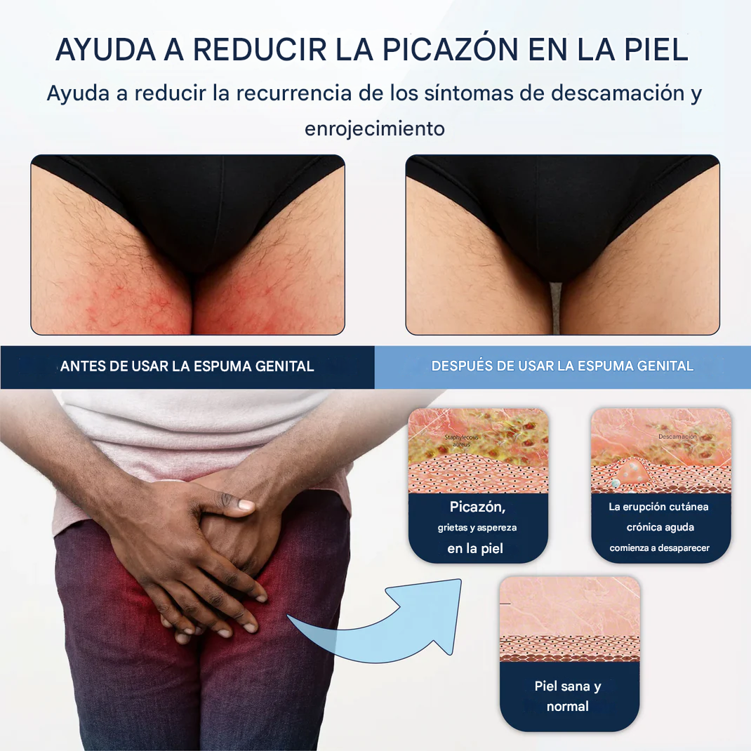 ATTDX® PsoriEase Espuma curativa de magnesio