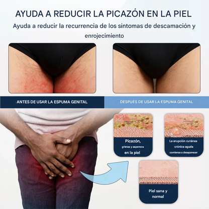 ATTDX® PsoriEase Espuma curativa de magnesio