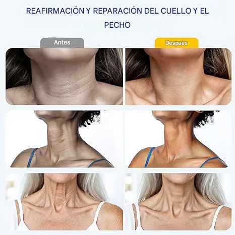 ✨ Crema reafirmante instantánea para el cuello — 🧴 Enriquecida con retinol y ácido hialurónico | Reafirma el cuello, reduce las arrugas y la papada