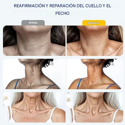 ✨ Crema reafirmante instantánea para el cuello — 🧴 Enriquecida con retinol y ácido hialurónico | Reafirma el cuello, reduce las arrugas y la papada
